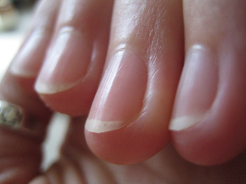 U&ntilde;as sanas
